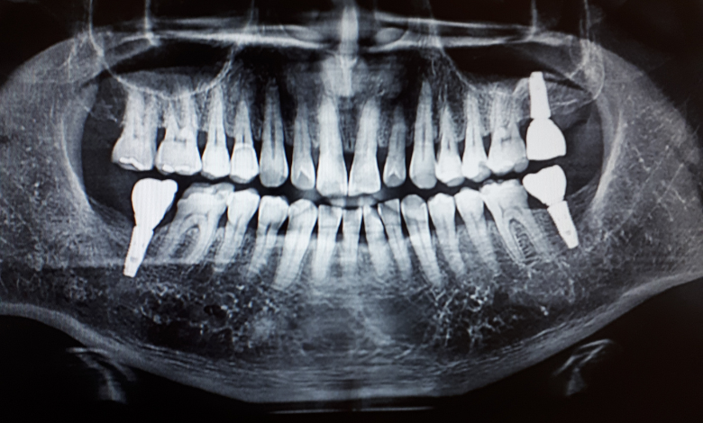 צילום סטטוס לשיניים – למה אתם צריכים את זה?