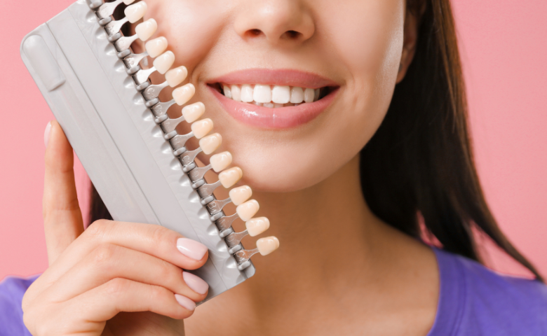ציפויי שיניים – אילו סוגים קיימים ולמי מתאים מה