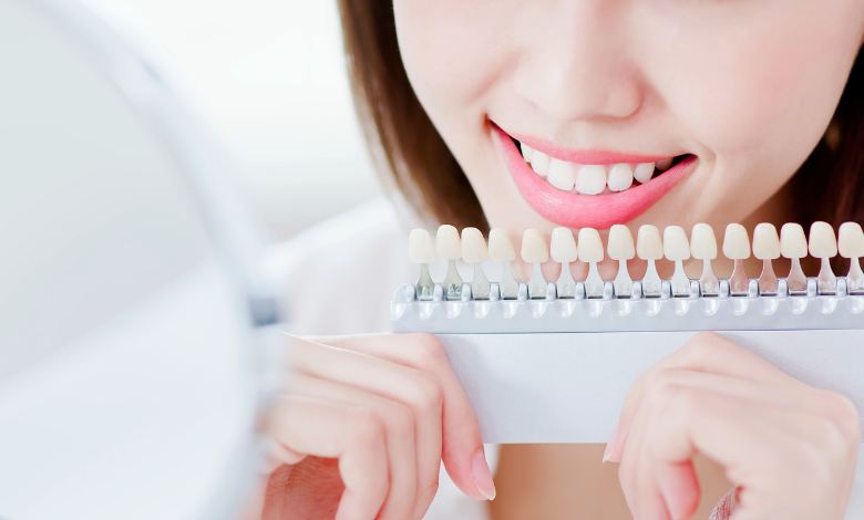 צמצום רווחים בשיניים – כל מה שעליכם לדעת