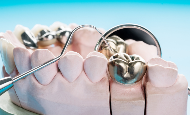 שיקום הפה בהרדמה מלאה – במיוחד בשביל מי שפוחד מטיפולי שיניים